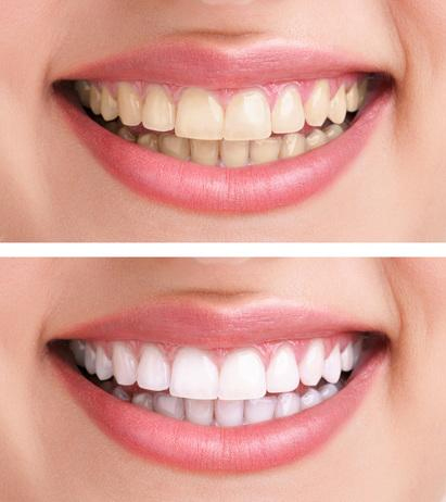 Before treatment